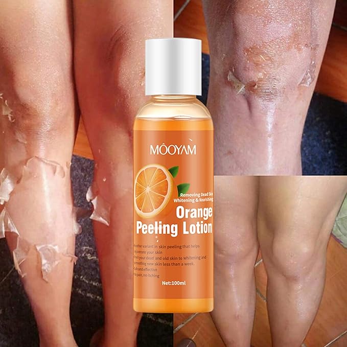 Zyvoura Mooyam Orange Peeling Lotion bottle with orange peel illustration, health and beauty product for skin exfoliation.